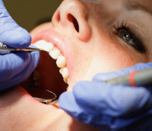 DENTAL CARE